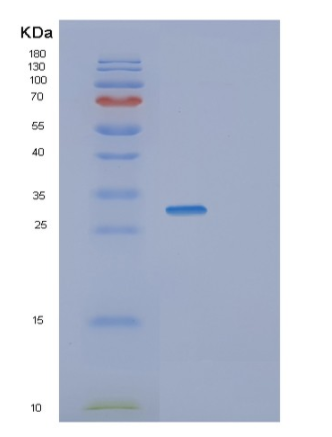 Recombinant Human SFRS1 Protein,Recombinant Human SFRS1 Protein