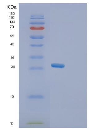 Recombinant Human SGCD Protein,Recombinant Human SGCD Protein