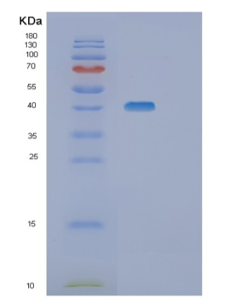 Recombinant Human SGK1 Protein,Recombinant Human SGK1 Protein