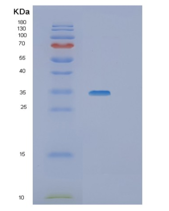 Recombinant Human SGTA Protein,Recombinant Human SGTA Protein