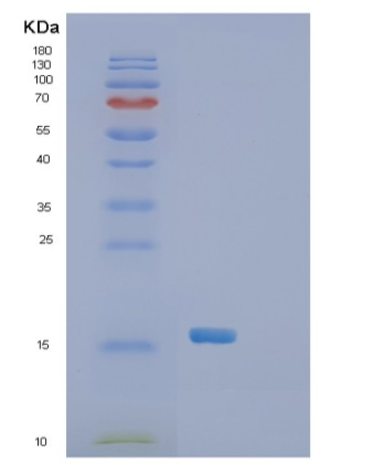 Recombinant Human SH2D1A Protein,Recombinant Human SH2D1A Protein