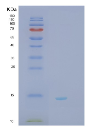Recombinant Human SH3BGRL2 Protein,Recombinant Human SH3BGRL2 Protein