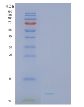 Recombinant Human SH3BGRL3 Protein,Recombinant Human SH3BGRL3 Protein