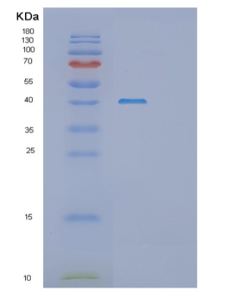 Recombinant Human SH3GL2 Protein,Recombinant Human SH3GL2 Protein