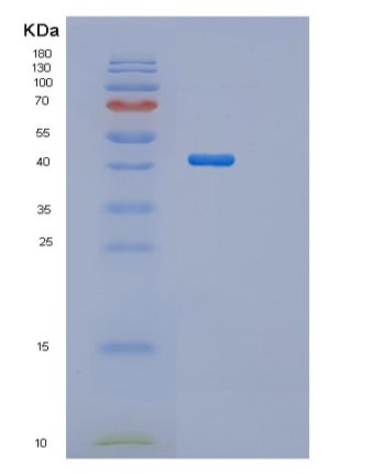 Recombinant Human SH3GL3 Protein,Recombinant Human SH3GL3 Protein