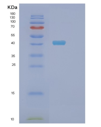 Recombinant Human SH3GLB1 Protein,Recombinant Human SH3GLB1 Protein