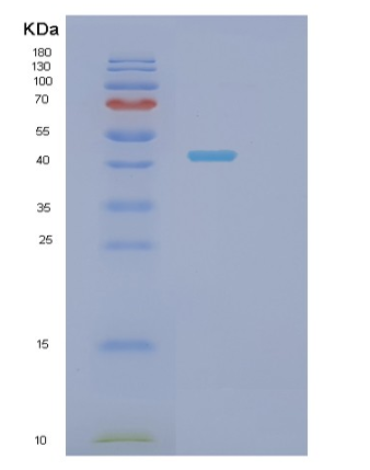 Recombinant Human SH3GLB2 Protein,Recombinant Human SH3GLB2 Protein