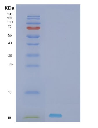 Recombinant Human SHFM1 Protein,Recombinant Human SHFM1 Protein