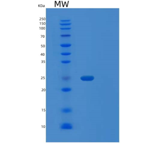 Recombinant Human RRAS2 Protein,Recombinant Human RRAS2 Protein