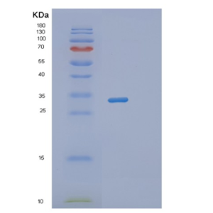 Recombinant Human RWDD1 Protein