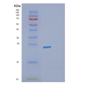 Recombinant Human RWDD4 Protein