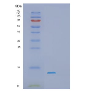 Recombinant Human S100A10 Protein