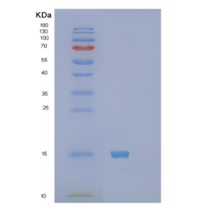 Recombinant Human S100A11 Protein