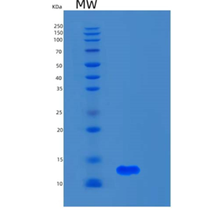 Recombinant Human S100A5 Protein