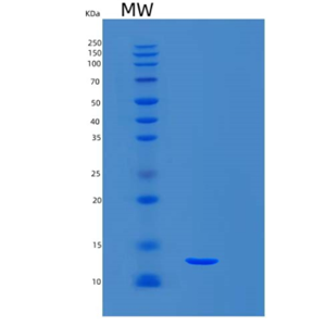 Recombinant Mouse S100A6 Protein,Recombinant Mouse S100A6 Protein