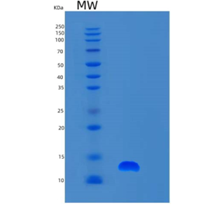 Recombinant Human S100A6 Protein