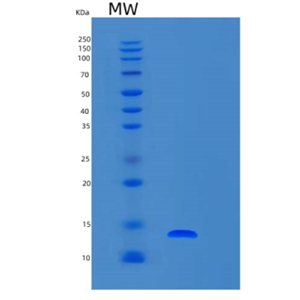 Recombinant Human S100A7 Protein