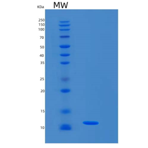 Recombinant Mouse S100A8 Protein,Recombinant Mouse S100A8 Protein