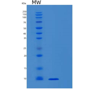 Recombinant Human S100B Protein