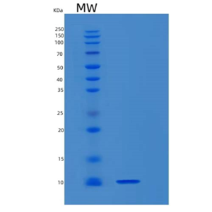 Recombinant Mouse S100b Protein,Recombinant Mouse S100b Protein