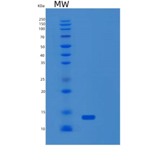 Recombinant Human S100Z Protein,Recombinant Human S100Z Protein