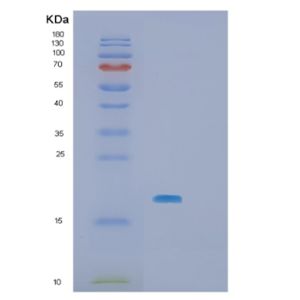 Recombinant Human SBDS Protein