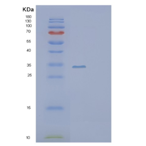 Recombinant Human SCGN Protein,Recombinant Human SCGN Protein