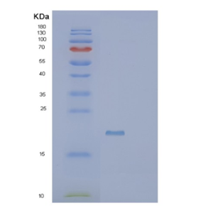 Recombinant Human SCP2D1 Protein,Recombinant Human SCP2D1 Protein