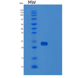 Recombinant Human SDF2 Protein,Recombinant Human SDF2 Protein