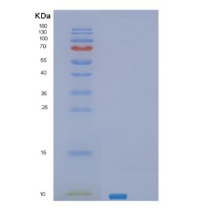 Recombinant Human SEC61B Protein,Recombinant Human SEC61B Protein