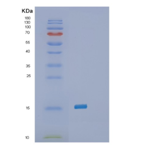 Recombinant Human SELH(SC44C) Protein,Recombinant Human SELH(SC44C) Protein