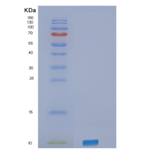 Recombinant Human SELPLG Protein,Recombinant Human SELPLG Protein