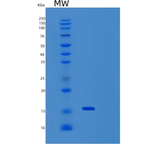 Recombinant Human SEP15 (SC96C) Protein