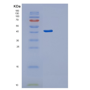 Recombinant Human Serpin A5 Protein