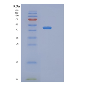 Recombinant Mouse Serpina9 Protein