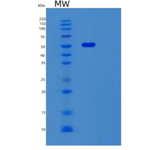 Recombinant Human SERPINC1 Protein