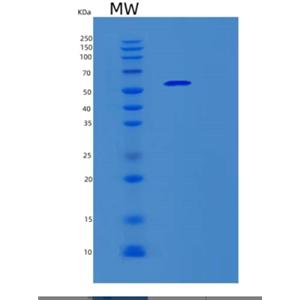 Recombinant Human SERPING1 Protein,Recombinant Human SERPING1 Protein