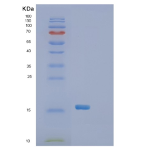 Recombinant Human SH2D1A Protein,Recombinant Human SH2D1A Protein