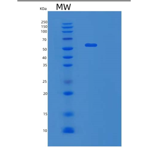 Recombinant Human SHMT1 Protein