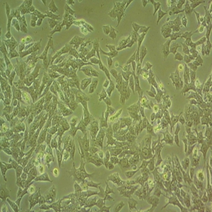 MC38小鼠结肠癌细胞,MC38