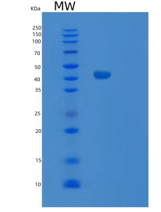 Recombinant Human SIRT2 Protein,Recombinant Human SIRT2 Protein