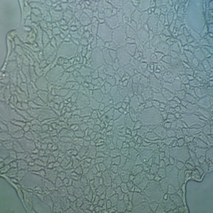 L615小鼠网织细胞性白血病细胞,L615