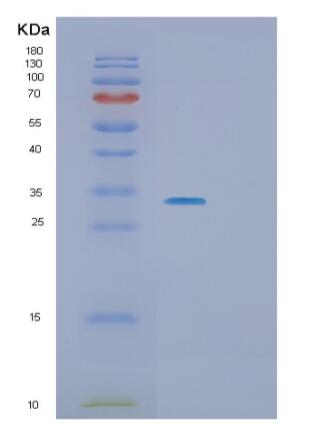 Recombinant Human SLA2 Protein,Recombinant Human SLA2 Protein