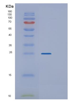 Recombinant Human SLAMF1 Protein,Recombinant Human SLAMF1 Protein