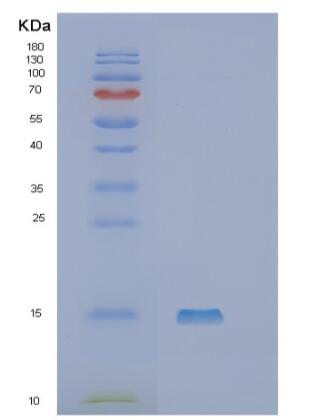 Recombinant Human SLPI Protein,Recombinant Human SLPI Protein