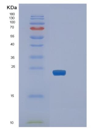 Recombinant Human SLAM family member 7 Protein,Recombinant Human SLAM family member 7 Protein