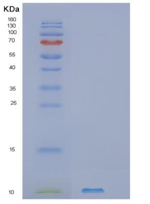 Recombinant Human SLC51B Protein,Recombinant Human SLC51B Protein