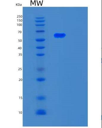 Recombinant Human SMAD4 Protein,Recombinant Human SMAD4 Protein