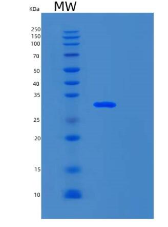 Recombinant Human SNAI2 Protein,Recombinant Human SNAI2 Protein