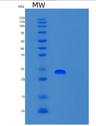 Recombinant Human SNAP23 Protein,Recombinant Human SNAP23 Protein